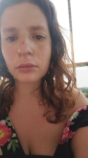 La foto invita da Sara Vega dal Pronto soccorso La foto invita da Sara Vega dal Pronto soccorso