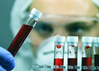 Giornata Ail, con ricerca e cura a fianco dei pazienti con neoplasie del sangue