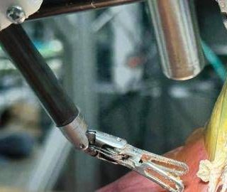 Il 'dottor robot' opera da solo, primo intervento senza aiuto umano