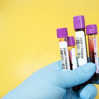 Coronavirus, i dati di mercoledì 10 febbraio: nel Varesotto 194 contagi. Varese +23, Busto +7, Gallarate +11, Saronno +3