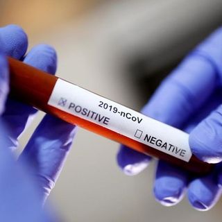 Coronavirus, in provincia numeri ai minimi da settimane: Varese +23, Busto +33, Gallarate +28, Saronno +12