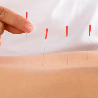 Apre all'ospedale di Circolo l'ambulatorio di agopuntura per i malati oncologici Apre all'ospedale di Circolo l'ambulatorio di agopuntura per i malati oncologici