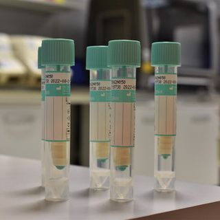 Covid, sono 83 i nuovi positivi registrati in provincia di Varese dall'ultimo bollettino