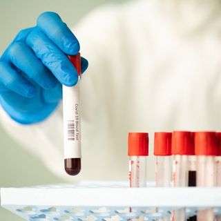 Coronavirus, in provincia di Varese 485 contagi. In Lombardia 6.362 casi e 22 vittime