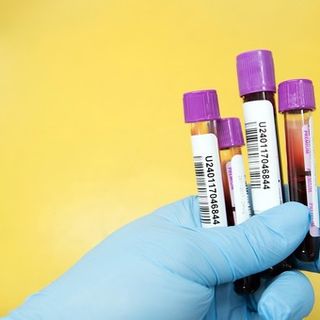 Coronavirus, in provincia di Varese sono 250 i nuovi contagi. In Lombardia 3.539 casi e 24 decessi