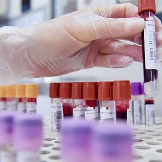 Coronavirus, un contagiato ricoverato all'ospedale di Legnano. Il governatore Fontana: «Situazione più stabile. Siamo fiduciosi». In arrivo mascherine e tamponi