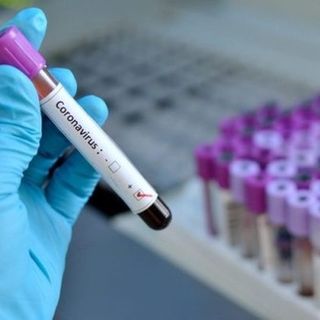 Il presidente Fontana aggiorna il bilancio: «Sono 89 i lombardi contagiati dal Coronavirus»