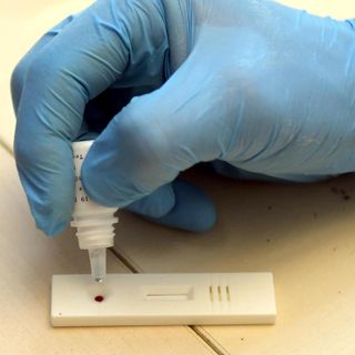 Test sieroligici, aumenta la popolazione campionata. I dati di Ats Test sieroligici, aumenta la popolazione campionata. I dati di Ats