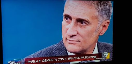 L'odontoiatra del braccio in silicone da Giletti: «Una provocazione, ma il giorno dopo mi sono vaccinato»