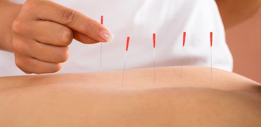 Apre all'ospedale di Circolo l'ambulatorio di agopuntura per i malati oncologici Apre all'ospedale di Circolo l'ambulatorio di agopuntura per i malati oncologici