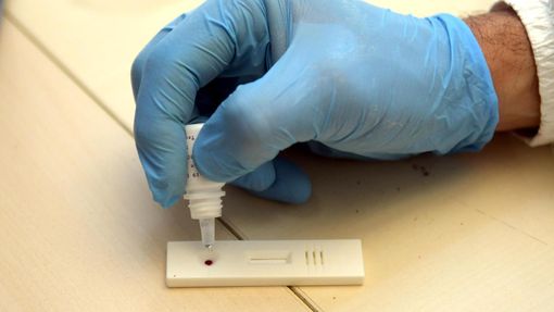 Test sieroligici, aumenta la popolazione campionata. I dati di Ats Test sieroligici, aumenta la popolazione campionata. I dati di Ats