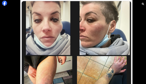 Le foto postate dalla cantante sulla sua pagina Facebook