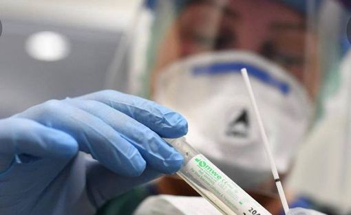 Covid-19, in Italia oggi 17.246 contagi e 522 vittime. Lombardia, Veneto e Sicilia le regioni più colpite