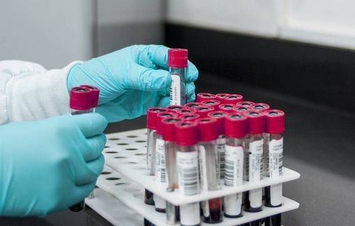 Una malattia non identificata in Congo sta provocando vittime. L'Oms: «Ipotesi agente patogeno respiratorio» Una malattia non identificata in Congo sta provocando vittime. L'Oms: «Ipotesi agente patogeno respiratorio»