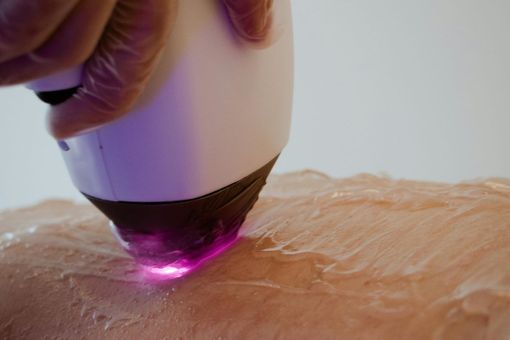 Scopri Unibeauty: Il Tuo Nuovo Centro Estetico a Ferrara e Bologna