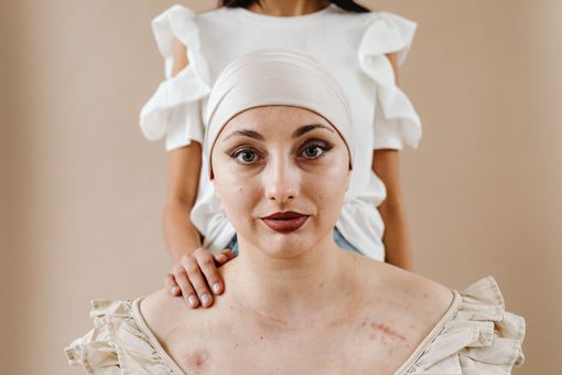 Le cicatrici da acne: causa, tipologia e soluzione a Cuneo