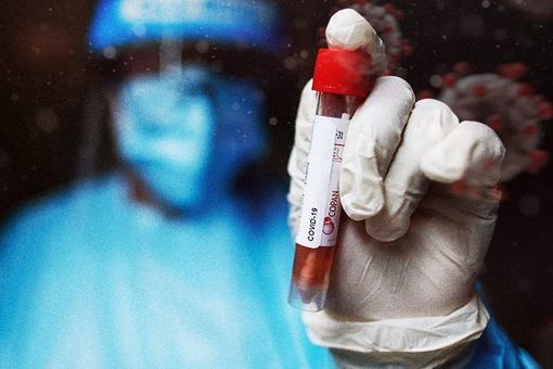 Covid-19, in Italia oggi 19.350 contagi. Lombardia +4.048, Veneto +2.535, Piemonte +1.617, Campania +1.113