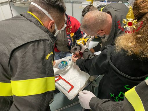 Anello incastrato al dito. Per rimuoverlo servono i vigili del fuoco