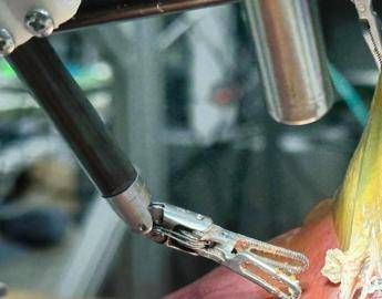 Il 'dottor robot' opera da solo, primo intervento senza aiuto umano