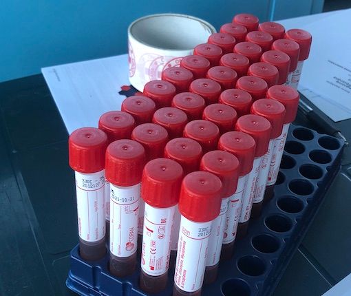 Coronavirus, comune per comune i dati dei contagi in provincia di Varese al 19 giugno