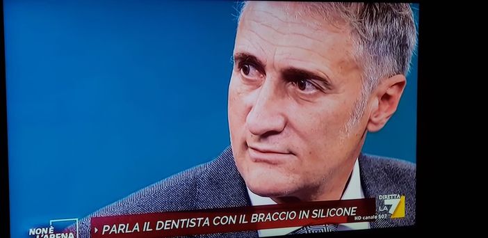 L'odontoiatra del braccio in silicone da Giletti: «Una provocazione, ma il giorno dopo mi sono vaccinato»