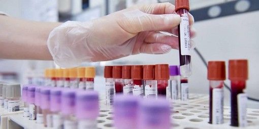 Covid, sono 57 i nuovi positivi registrati in provincia di Varese dall'ultimo bollettino