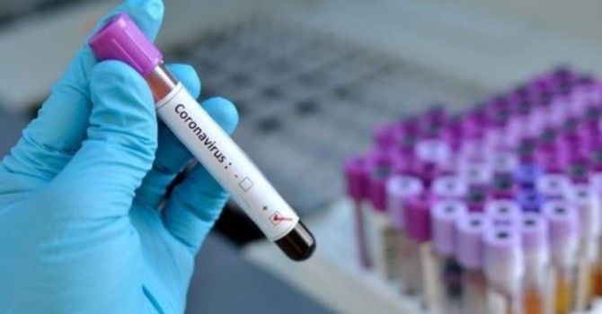 Coronavirus, resta critica la situazione di una rsa di Ispra: decessi saliti a 17 Coronavirus, resta critica la situazione di una rsa di Ispra: decessi saliti a 17