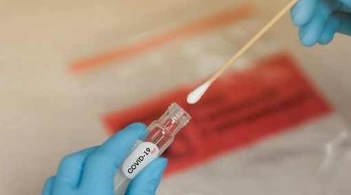 Covid, in Italia 5.456 nuovi positivi ma con oltre 28mila tamponi in meno di ieri. In terapia intensiva 30 persone in più, 26 decessi