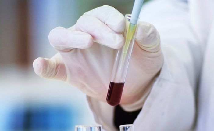 Punti prelievi, dopo Viggiù a pieno regime anche Malnate Punti prelievi, dopo Viggiù a pieno regime anche Malnate