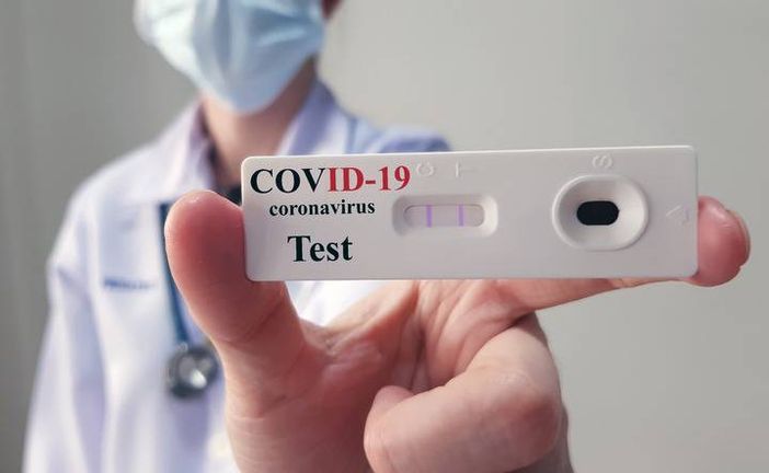 Coronavirus, attenzione al business dei test sierologici. Monti: «Quelli in commercio hanno una scarsa attendibilità» Coronavirus, attenzione al business dei test sierologici. Monti: «Quelli in commercio hanno una scarsa attendibilità»