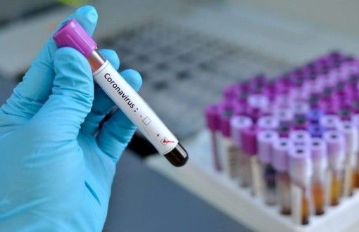 Coronavirsus, per l’Organizzazione Mondiale della Sanità può essere considerato pandemia