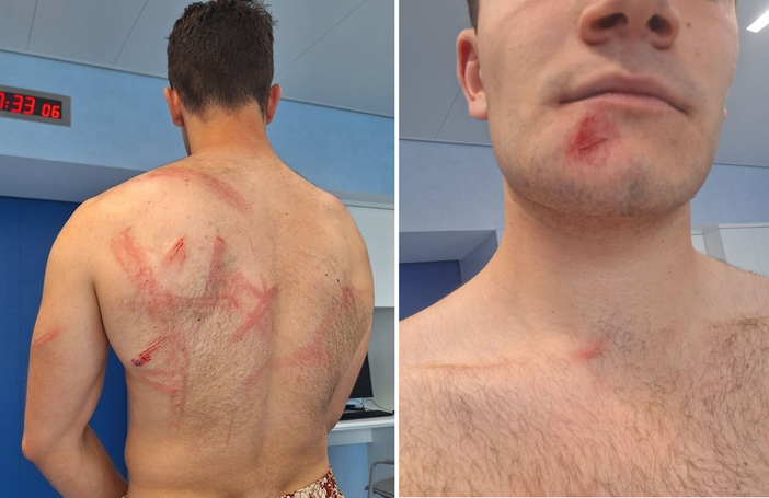 Le foto postate su X da Andrea Ballarati Le foto postate su X da Andrea Ballarati