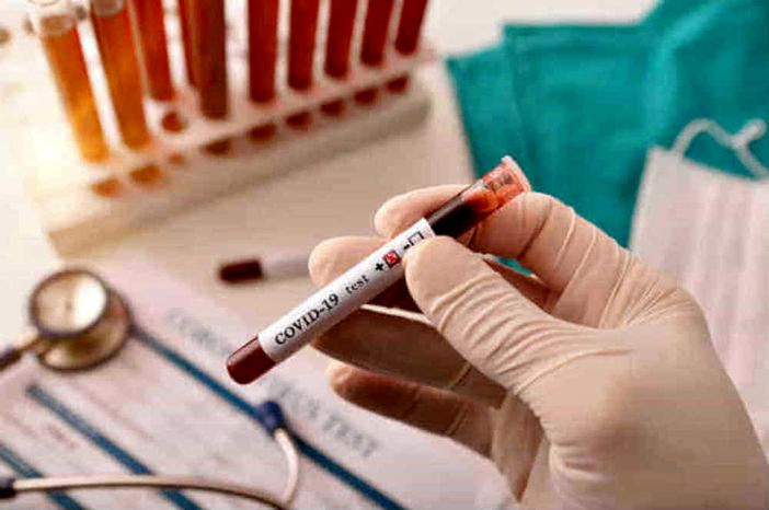 Test sierologici a carico dei privati, Carignola (PD): «Scelta scellerata che penalizza il nostro territorio»