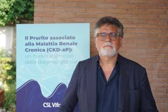 Nefrologi: "Successo in 85% casi per cura contro prurito in malattia renale cronica" Nefrologi: "Successo in 85% casi per cura contro prurito in malattia renale cronica"