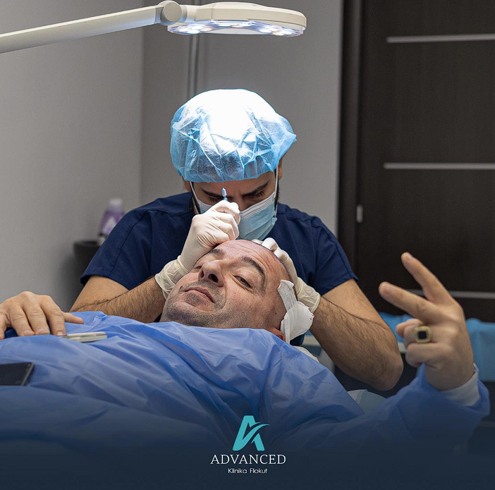 Qual è il vero paese migliore per il trapianto di capelli?