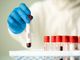 Coronavirus, in provincia di Varese 1.973 nuovi contagi. In Lombardia 26.773 casi, in Italia 149.512