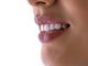 Implantologia ed estetica dentale: le nuove tecnologie che stanno cambiando il settore