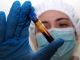 Hantavirus, negativo il turista inglese in quarantena a Milano Hantavirus, negativo il turista inglese in quarantena a Milano
