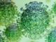 Positivo al test del Coronavirus un cittadino di Solbiate Olona
