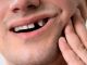 Denti mancanti? Ecco le migliori soluzioni per ritrovare il sorriso