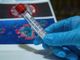 Coronavirus, oggi 22 contagi in provincia di Varese. In Lombardia 461 casi e 1 vittima