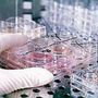 Fecondazione, non solo endometriosi: il nuovo protocllo che combatte l'adenomiosi