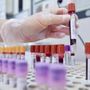 Sibioc, su ipotesi Regione Lazio: &quot;No esternalizzazione medicina di laboratorio&quot;