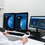 Alla Mater Domini di Castellanza l'intelligenza artificiale per la diagnosi precoce dei tumori al seno