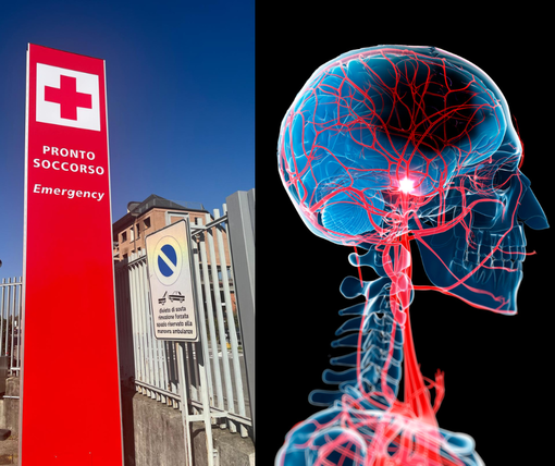 Un farmaco innovativo contro l’ictus ischemico: il tenecteplase arriva in Asst Valle Olona Un farmaco innovativo contro l’ictus ischemico: il tenecteplase arriva in Asst Valle Olona