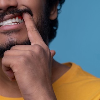 Sanguinamento gengive: cause comuni e quando preoccuparsi davvero
