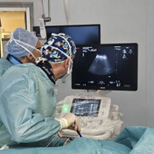 Busto, intervento mininvasivo innovativo per trattare un epatocarcinoma Busto, intervento mininvasivo innovativo per trattare un epatocarcinoma