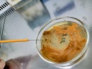 Crescita in solido del microrganismo produttore della kineomicina