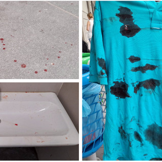 Le tracce di sangue sul pavimento e sul lavandino: la maglietta sporca di sangue con il quale è stata tamponata la ferita della vittima