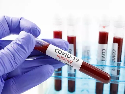 Coronavirus, i dati di martedì 27 ottobre: nel Varesotto 263 contagi. Varese +16, Busto +33, Gallarate +17, Saronno +29